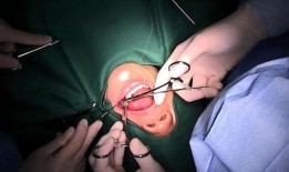 佛山种牙爆料事件最新,揭露行业乱象，患者权益如何保障？